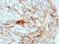 Elastin Antibody (ELN/3131R) - Azide and BSA Free, Novus Biologicals 100 &mu;g | Buy Online | Novus Biologicals | Fisher Scientific